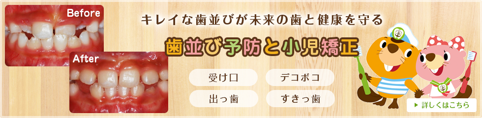 歯並び予防と小児矯正：キレイな歯並びが未来の歯と健康を守る　受け口・デコボコ・出っ歯・すきっ歯	